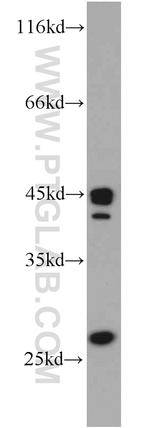 SCO2 Antibody in Western Blot (WB)