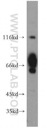 FOXJ3 Antibody in Western Blot (WB)