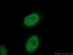 E2A Antibody in Immunocytochemistry (ICC/IF)