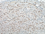 ER Antibody in Immunohistochemistry (Paraffin) (IHC (P))