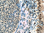 ER Antibody in Immunohistochemistry (Paraffin) (IHC (P))