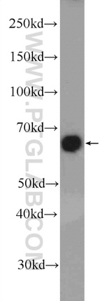 ER Antibody in Western Blot (WB)