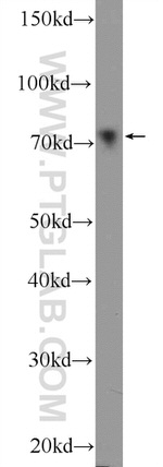 ER Antibody in Western Blot (WB)