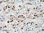 ER Antibody in Immunohistochemistry (Paraffin) (IHC (P))