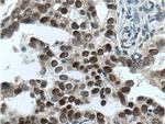 ER Antibody in Immunohistochemistry (Paraffin) (IHC (P))