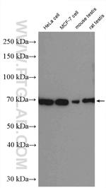 ER Antibody in Western Blot (WB)