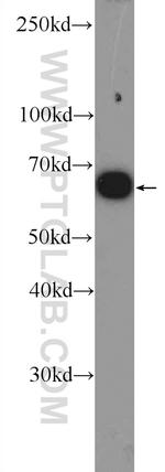 ER Antibody in Western Blot (WB)