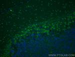 SYT2 Antibody in Immunohistochemistry (PFA fixed) (IHC (PFA))