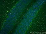 SYT2 Antibody in Immunohistochemistry (PFA fixed) (IHC (PFA))