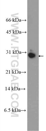 HMGB3L1 Antibody in Western Blot (WB)