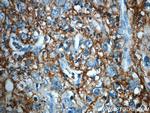 ITIH3 Antibody in Immunohistochemistry (Paraffin) (IHC (P))