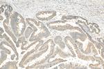 WISP3 Antibody in Immunohistochemistry (Paraffin) (IHC (P))
