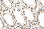 WISP3 Antibody in Immunohistochemistry (Paraffin) (IHC (P))