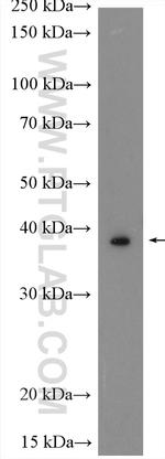 WISP3 Antibody in Western Blot (WB)