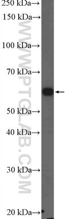 Catalase Antibody in Western Blot (WB)