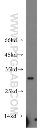 NEURL2 Antibody in Western Blot (WB)