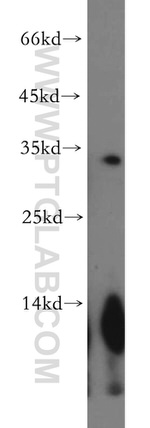 NEURL2 Antibody in Western Blot (WB)
