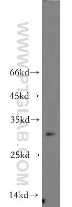 NEURL2 Antibody in Western Blot (WB)