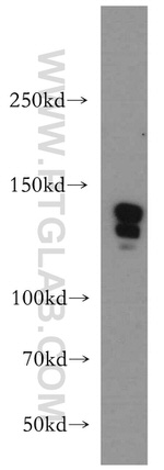 CTR9 Antibody in Western Blot (WB)