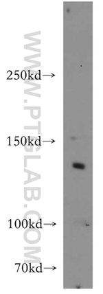 CTR9 Antibody in Western Blot (WB)