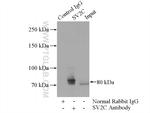 SV2C Antibody in Immunoprecipitation (IP)