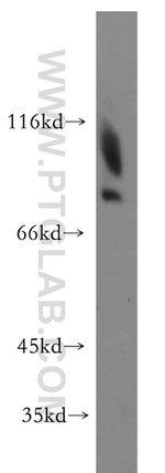 SV2C Antibody in Western Blot (WB)