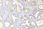 TMEM64 Antibody in Immunohistochemistry (Paraffin) (IHC (P))