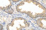 TMEM64 Antibody in Immunohistochemistry (Paraffin) (IHC (P))