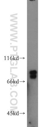 SR-BI Antibody in Western Blot (WB)