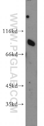 SR-BI Antibody in Western Blot (WB)