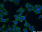 AMIGO3 Antibody in Immunocytochemistry (ICC/IF)