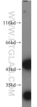 AMIGO3 Antibody in Western Blot (WB)