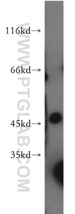 AMIGO3 Antibody in Western Blot (WB)