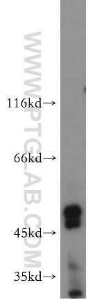 AMIGO3 Antibody in Western Blot (WB)