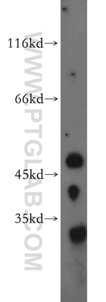 AMIGO3 Antibody in Western Blot (WB)