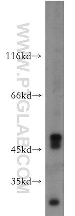 AMIGO3 Antibody in Western Blot (WB)