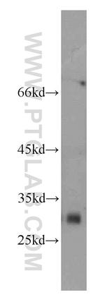MOGAT2 Antibody in Western Blot (WB)