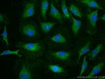 SLC39A2 Antibody in Immunocytochemistry (ICC/IF)