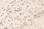 SLC39A2 Antibody in Immunohistochemistry (Paraffin) (IHC (P))