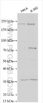 SLC39A2 Antibody in Western Blot (WB)