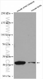 B3GNT6 Antibody in Western Blot (WB)
