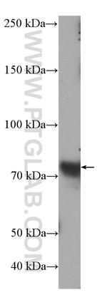 SLC34A2 Antibody in Western Blot (WB)