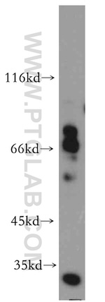 Kv4.2 Antibody in Western Blot (WB)