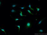 PLK5 Antibody in Immunocytochemistry (ICC/IF)
