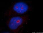 PLK5 Antibody in Immunocytochemistry (ICC/IF)