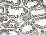 PLK5 Antibody in Immunohistochemistry (Paraffin) (IHC (P))
