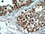 PLK5 Antibody in Immunohistochemistry (Paraffin) (IHC (P))