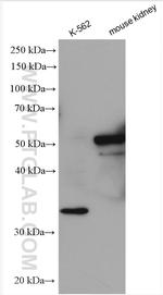PLK5 Antibody in Western Blot (WB)