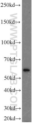 PLK5 Antibody in Western Blot (WB)