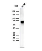 Albumin (Transport Protein) Antibody in Western Blot (WB)